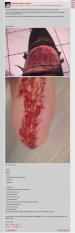 Wunden selbst machen.png