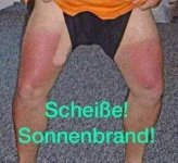 Sonnenbrand.jpg